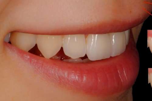 长春净月开发区牙齿矫正医院